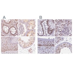 Merck Anti-PPP1R10 antibody produced in rabbit