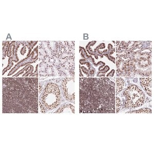 Merck Anti-XRCC6 antibody produced in rabbit