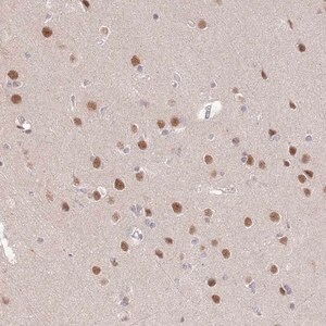 Merck Anti-ZBTB7A antibody produced in rabbit