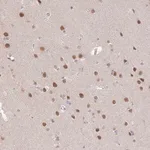 Merck Anti-ZBTB7A antibody produced in rabbit
