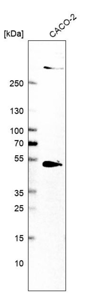 Merck Anti-SMYD5 antibody produced in rabbit