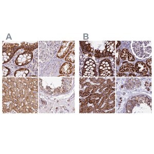 Merck Anti-UQCRFS1 antibody produced in rabbit