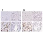 Merck Anti-KCNE2 antibody produced in rabbit