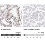 Merck Anti-ADAR antibody produced in rabbit