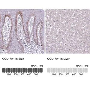 Merck Anti-COL17A1 antibody produced in rabbit
