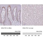 Merck Anti-COL17A1 antibody produced in rabbit
