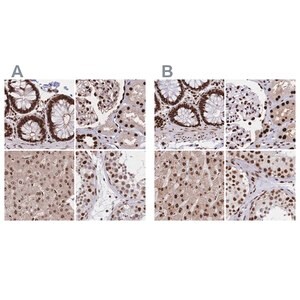 Merck Anti-HDGF antibody produced in rabbit