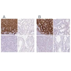 Merck Anti-CYP21A2 antibody produced in rabbit