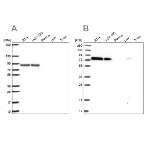 Merck Anti-DYNC1I2 antibody produced in rabbit