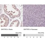 Merck Anti-DNTTIP2 antibody produced in rabbit
