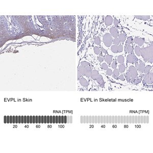 Merck Anti-EVPL antibody produced in rabbit