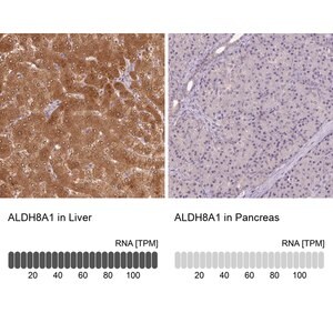 Merck Anti-ALDH8A1 antibody produced in rabbit