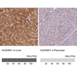 Merck Anti-ALDH8A1 antibody produced in rabbit