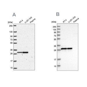 Merck Anti-MRPL28 antibody produced in rabbit