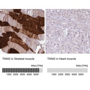 Merck Anti-TNNI2 antibody produced in rabbit
