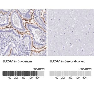 Merck Anti-SLC5A1 antibody produced in rabbit