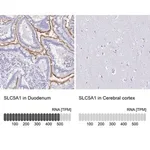 Merck Anti-SLC5A1 antibody produced in rabbit