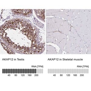 Merck Anti-AKAP12 antibody produced in rabbit