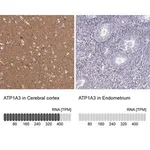 Merck Anti-ATP1A3 antibody produced in rabbit
