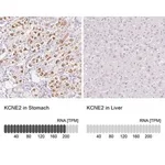 Merck Anti-KCNE2 antibody produced in rabbit