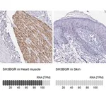 Merck Anti-SH3BGR antibody produced in rabbit
