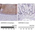 Merck Anti-SERPINB13 antibody produced in rabbit