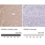 Merck Anti-KCNQ2 antibody produced in rabbit