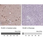 Merck Anti-PLCB1 antibody produced in rabbit