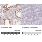 Merck Anti-SUV39H2 antibody produced in rabbit