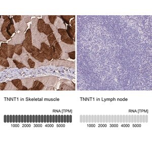Merck Anti-TNNT1 antibody produced in rabbit