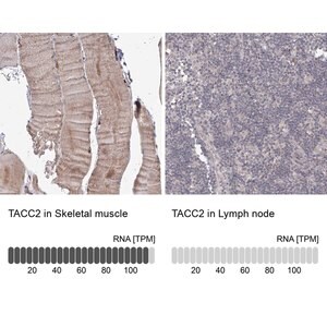 Merck Anti-TACC2 antibody produced in rabbit