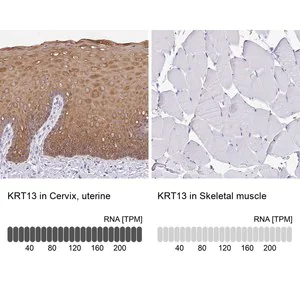 Merck Anti-KRT13 antibody produced in rabbit