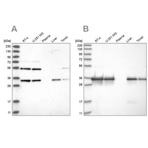 Merck Anti-PPA2 antibody produced in rabbit