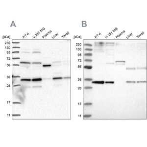 Merck Anti-PPCS antibody produced in rabbit
