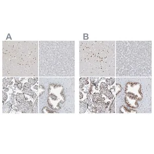 Merck Anti-WRNIP1 antibody produced in rabbit