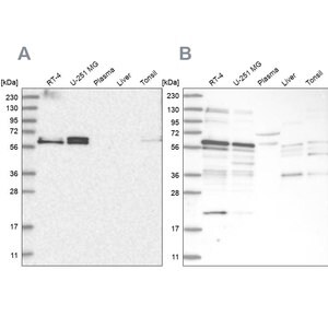 Merck Anti-TSPYL1 antibody produced in rabbit