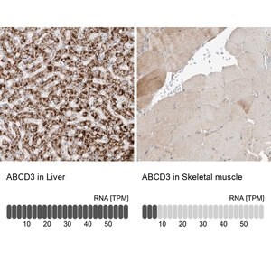 Merck Anti-ABCD3 antibody produced in rabbit
