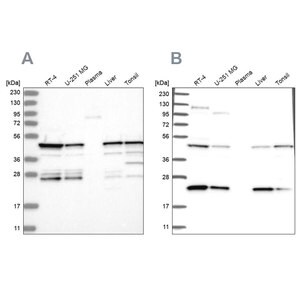 Merck Anti-PPP1R7 antibody produced in rabbit