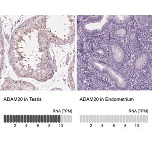 Merck Anti-ADAM20 antibody produced in rabbit