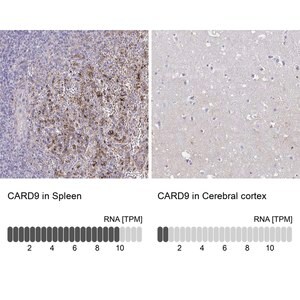 Merck Anti-CARD9 antibody produced in rabbit