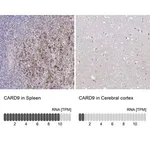 Merck Anti-CARD9 antibody produced in rabbit