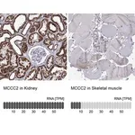 Merck Anti-MCCC2 antibody produced in rabbit
