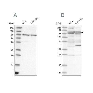 Merck Anti-TBC1D5 antibody produced in rabbit