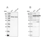 Merck Anti-TBC1D5 antibody produced in rabbit