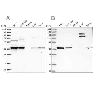 Merck Anti-TBCC antibody produced in rabbit