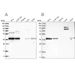 Merck Anti-TBCC antibody produced in rabbit