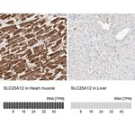 Merck Anti-SLC25A12 antibody produced in rabbit