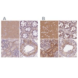 Merck Anti-ADD1 antibody produced in rabbit