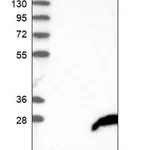 Merck Anti-FAM206A antibody produced in rabbit