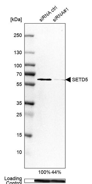 Merck Anti-SETD5 antibody produced in rabbit